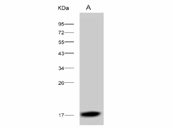 Anti-Dengue virus DENV-2(Strain New Guinea C) Capsid protein/DENV-C Monoclonal Antibody (E-AB-V1061)