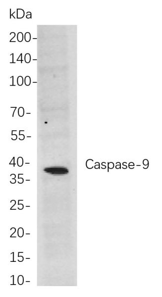 Recombinant Caspase-9 Monoclonal Antibody (AN301044L)