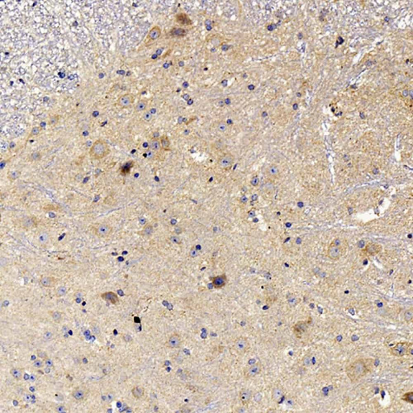 NOS2 Polyclonal Antibody (E-AB-70051)