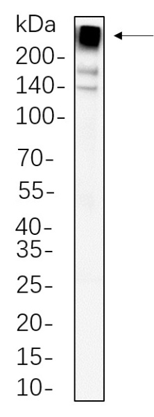 Recombinant Acetyl Coenzyme A Carboxylase beta Monoclonal Antibody (AN300810L)