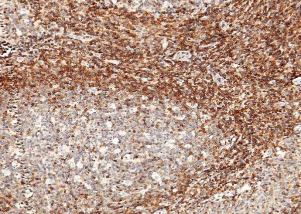 Recombinant IL-16 Monoclonal Antibody (AN300355P)