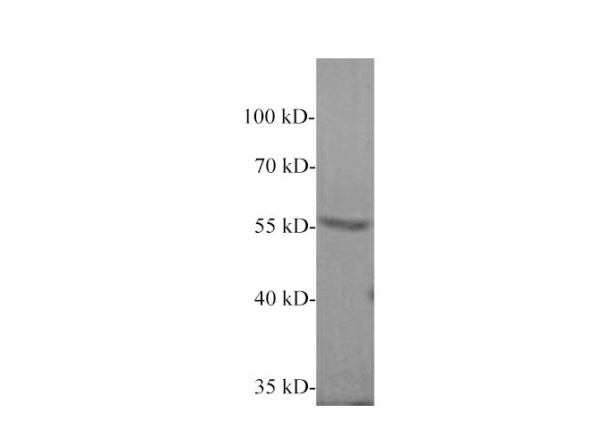 Carboxypeptidase B2 Polyclonal Antibody (E-AB-40640)