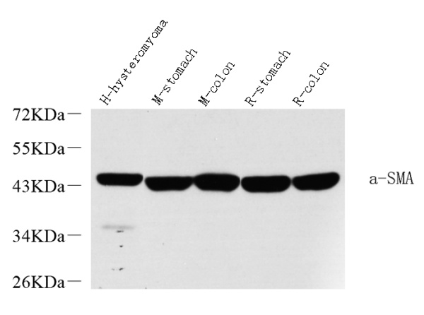 ACTA2 Polyclonal Antibody (E-AB-70226)
