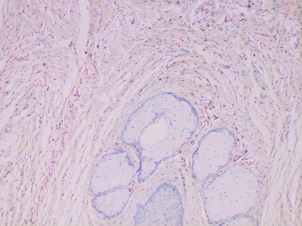 S100A4 Monoclonal Antibody (ELAB6495-M)