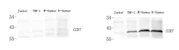 CCR7 Polyclonal Antibody (E-AB-70359)