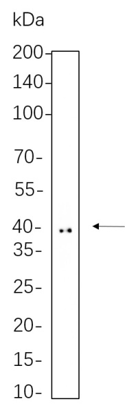 Recombinant Doublecortin Monoclonal Antibody (AN301300L)