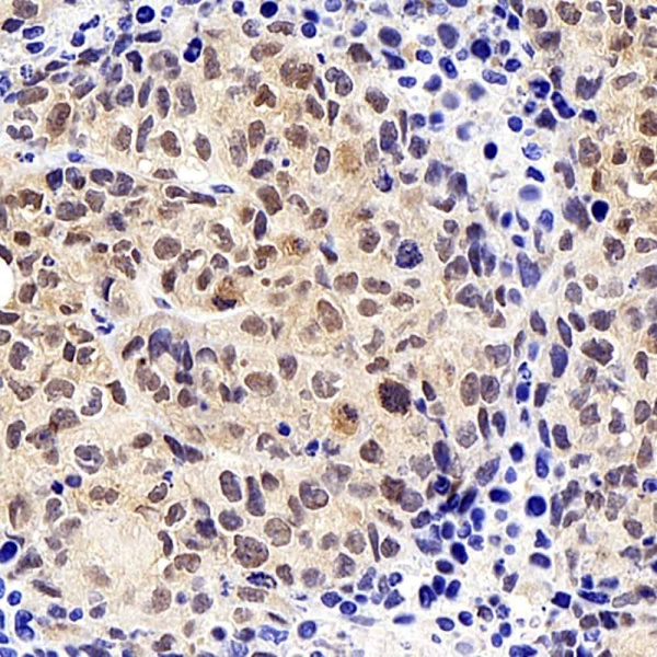 SOX-2 Polyclonal Antibody (E-AB-70108)