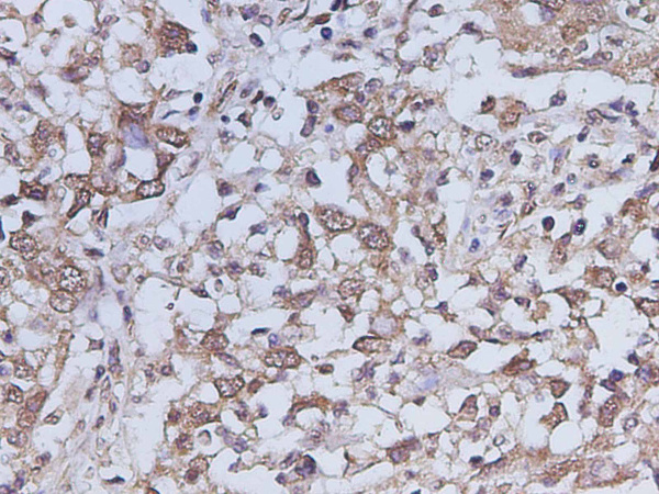 IL-17A Polyclonal Antibody (D-AB-10452L)