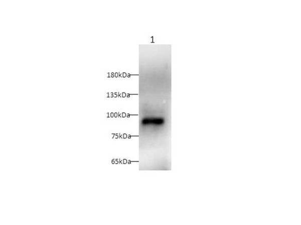 CD105 Polyclonal Antibody (AN007250L)