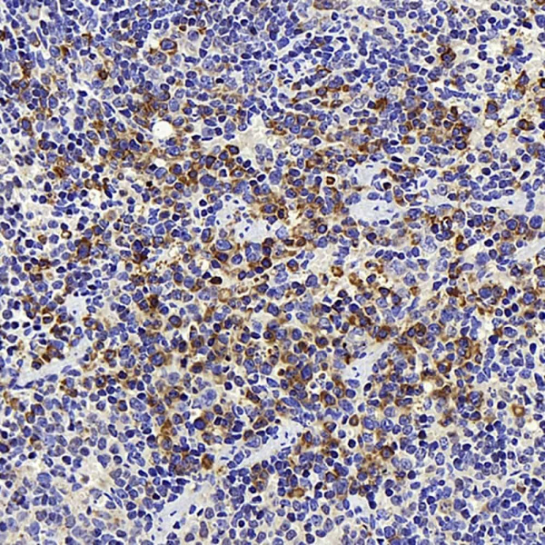 ATG7 Polyclonal Antibody (E-AB-70287)
