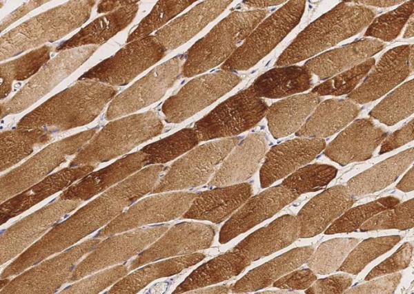 CKM Monoclonal Antibody (AN200244P)
