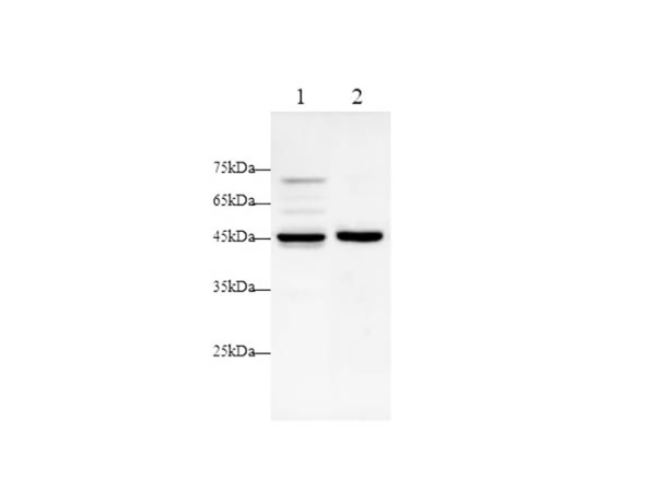 ANGPTL4 Polyclonal antibody (AN006110L)