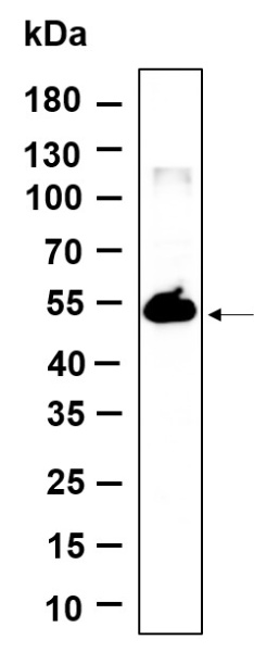 Recombinant TMEM161B Monoclonal Antibody (AN301209L)