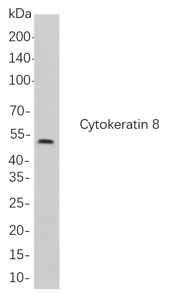 Recombinant Cytokeratin 8 Monoclonal Antibody (AN300964L)
