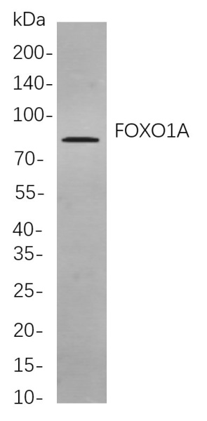 Recombinant FOXO1A Monoclonal Antibody (AN301054L)