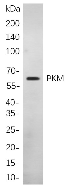 Recombinant PKM Monoclonal Antibody (AN301098L)