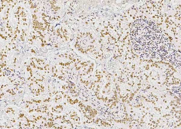 Recombinant STK4/MST1 Monoclonal Antibody (AN300401P)