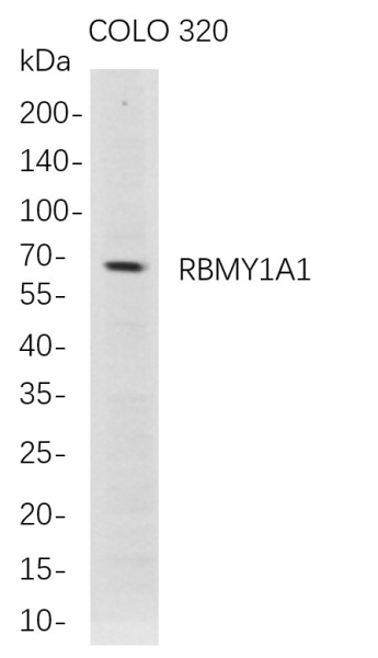 Recombinant RBMY1A1 Monoclonal Antibody (AN300780L)