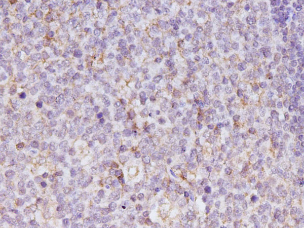 IL-17A Polyclonal Antibody (D-AB-10453L)