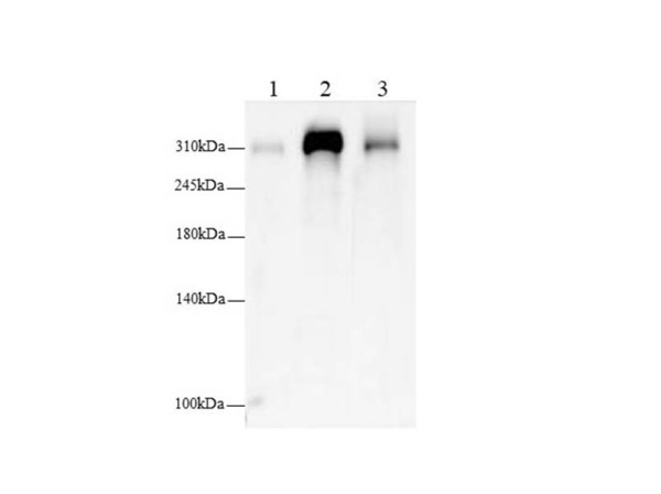 FLNC Polyclonal Antibody (AN006990L)