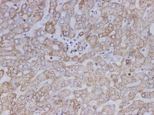 SDHB Polyclonal Antibody (D-AB-10362L)