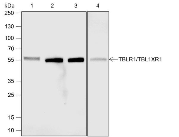Recombinant TBLR1/TBL1XR1 Monoclonal Antibody (AN301924L)