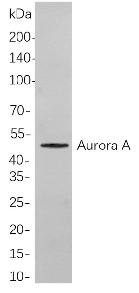 Recombinant Aurora A Monoclonal Antibody (AN301108L)