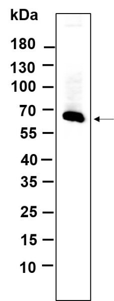 Recombinant MMP2 Monoclonal Antibody (AN300712L)