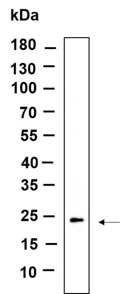 Recombinant GPX1 Monoclonal Antibody (AN301163L)