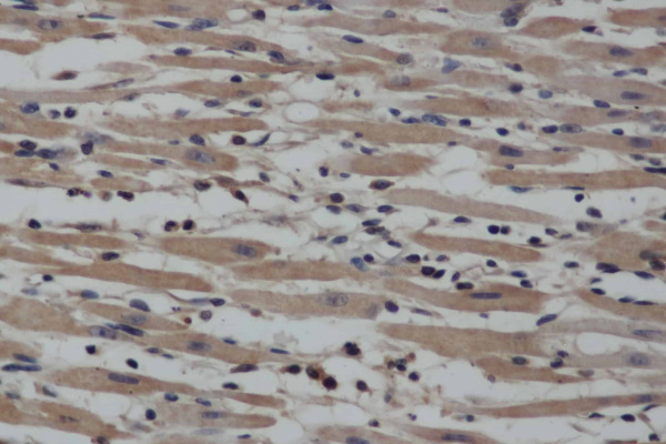 NOS2 Polyclonal Antibody (E-AB-10495)