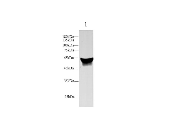 SERPINA6 Polyclonal Antibody (D-AB-10351L)
