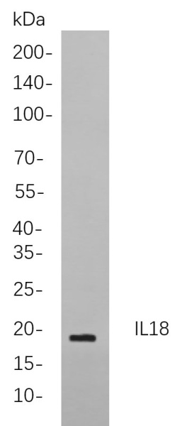 Recombinant IL18 Monoclonal Antibody (AN301078L)