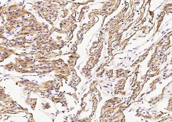 Desmin Monoclonal Antibody (AN200156P)