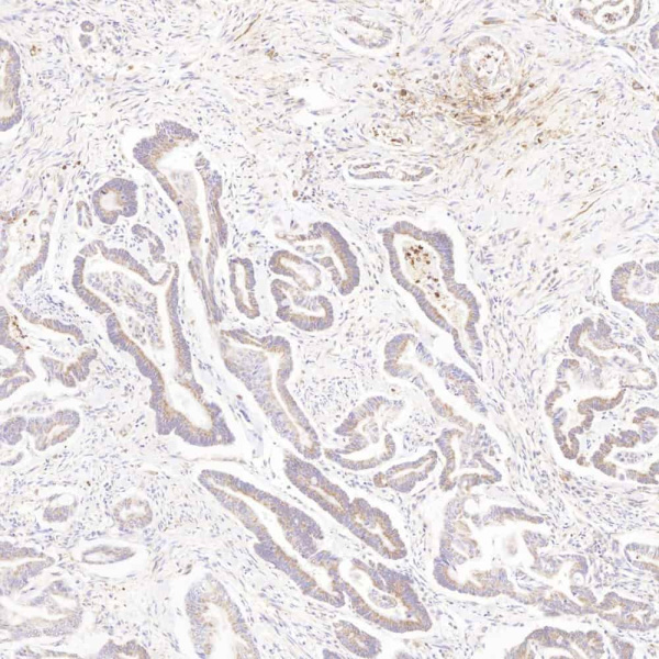MMP2 Polyclonal Antibody (E-AB-70057)