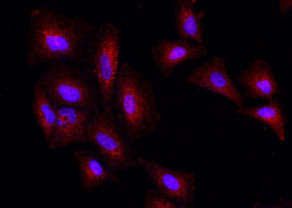 Recombinant PSPH Monoclonal Antibody (AN300269P)