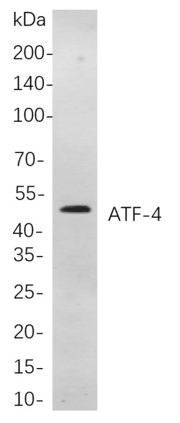 Recombinant ATF-4 Monoclonal Antibody (AN301041L)