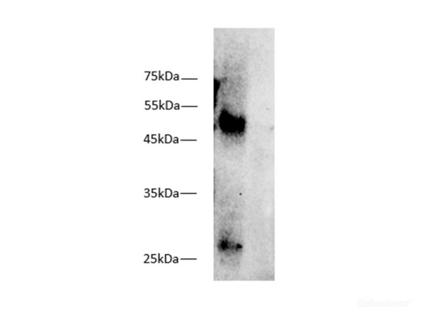 MHC class I Monoclonal Antibody(W6/32) (E-AB-48031)