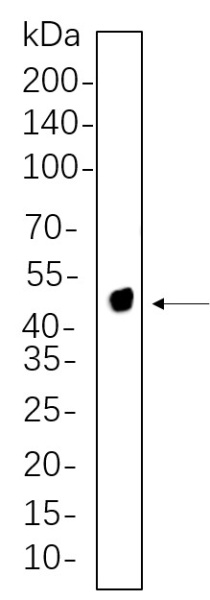 Recombinant NDRG1 Monoclonal Antibody (AN300663L)