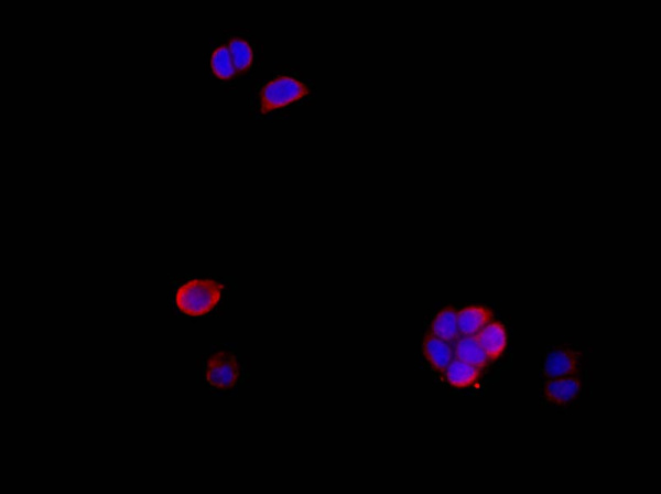 Amphiregulin Polyclonal Antibody (AN005810L)