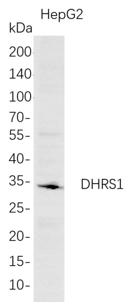 Recombinant DHRS1 Monoclonal Antibody (AN300754L)