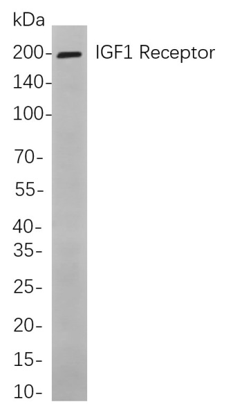 Recombinant IGF1 Receptor Monoclonal Antibody (AN301096L)