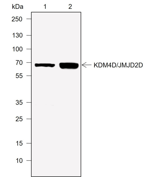 Recombinant JMJD2D Monoclonal Antibody (AN302018L)