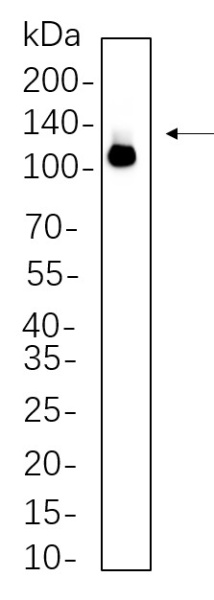 Recombinant DDX58 Monoclonal Antibody (AN300675L)