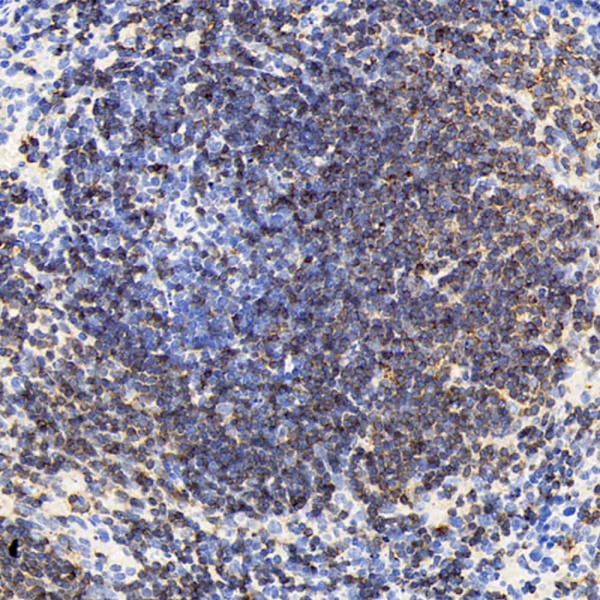 CD19 Polyclonal Antibody (E-AB-70252)