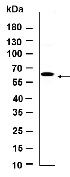 Recombinant Phospho-p70 S6 kinase β (Ser371) Monoclonal Antibody (AN301151L)