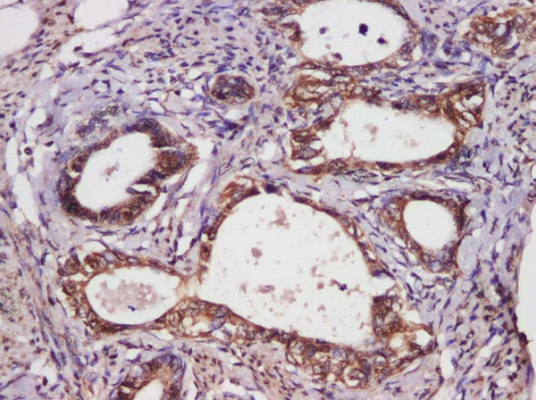 Bcl-2 Polyclonal Antibody (AN006000L)