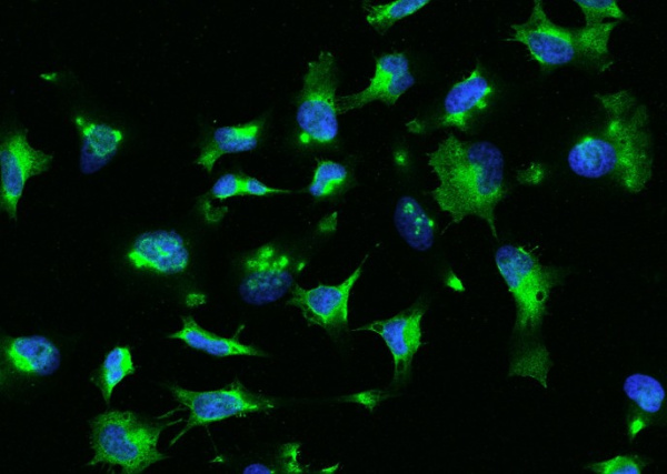 Recombinant RhoA Monoclonal Antibody (AN300421P)