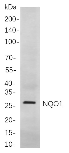 Recombinant NQO1 Monoclonal Antibody (AN300988L)