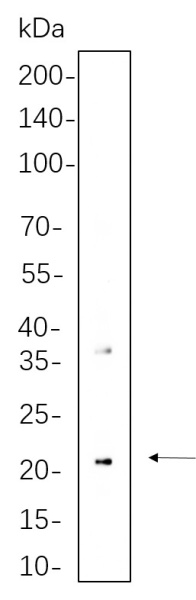 Recombinant CD90 Monoclonal Antibody (AN300606L)