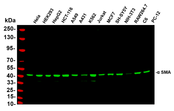 Recombinant α smooth muscle actin Monoclonal Antibody (AN301012L)